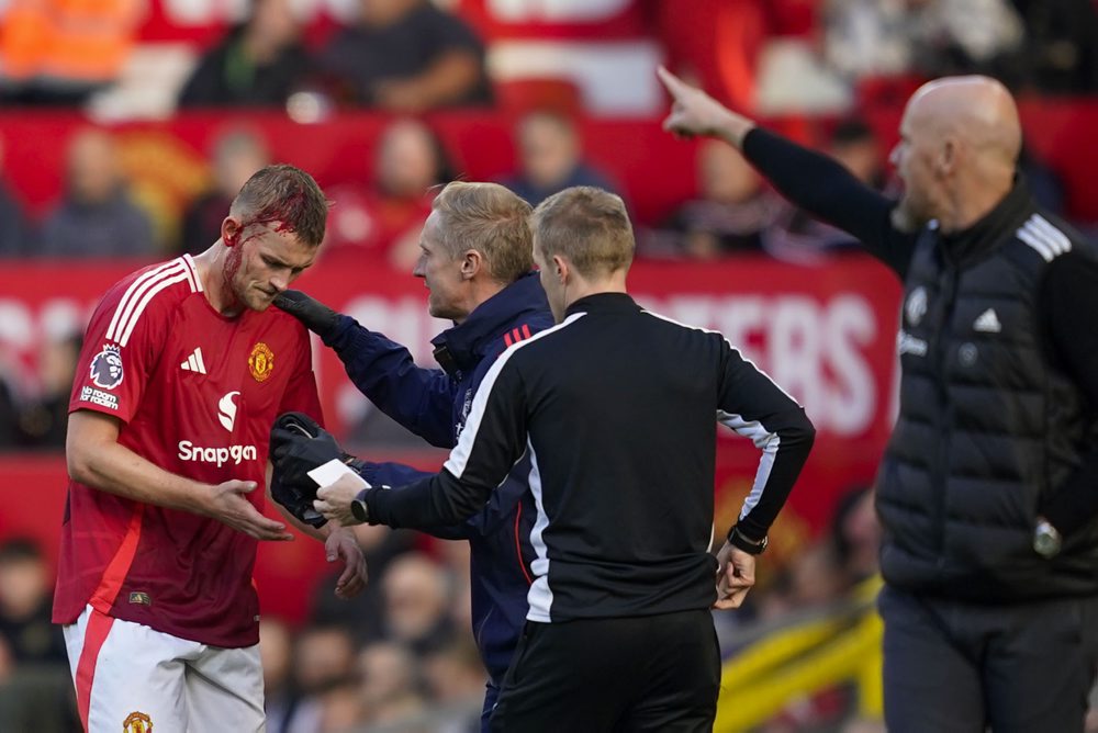 Manchester United - FC Brentford